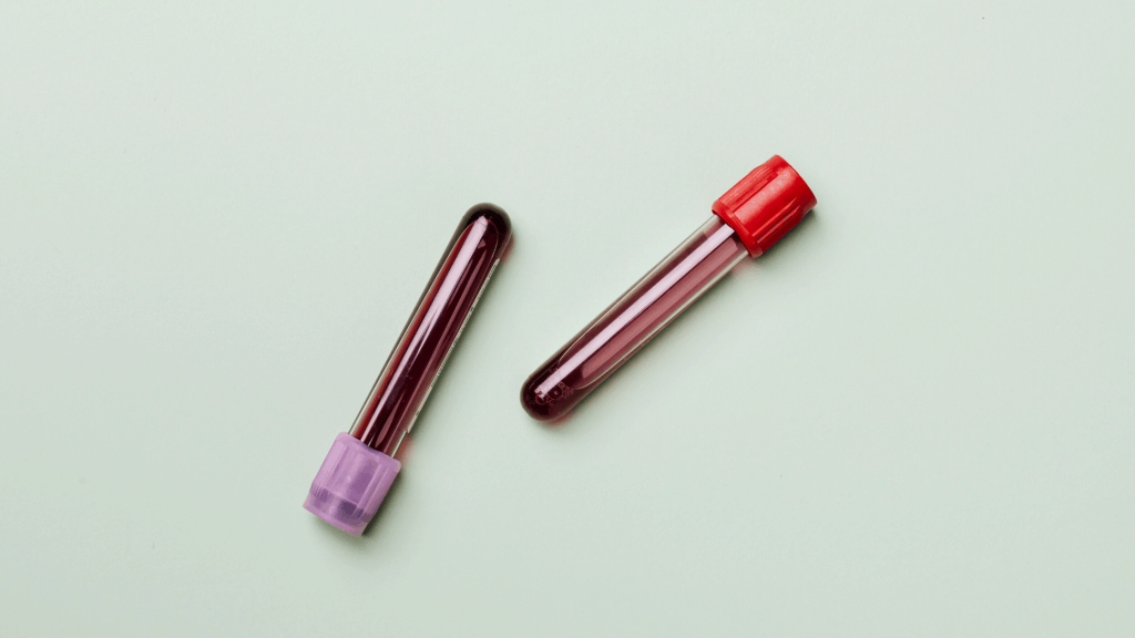 blood samples in vials